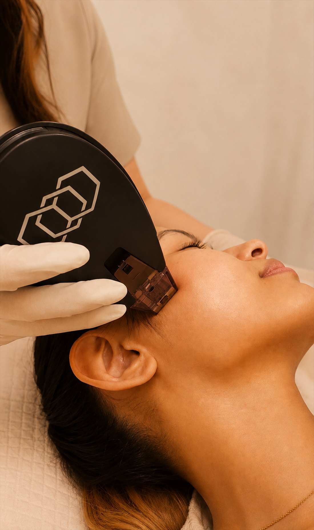 The Morpheus8 handpiece during a treatment at JUNISH — sculpt, define, illuminate